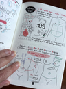 Diep-reconstruction-mammaire-BD-cancer-du-sein.webp